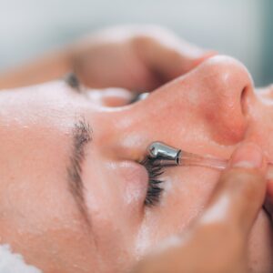 שחור מתחת לעיניים