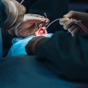 ניתוח אף החלמה